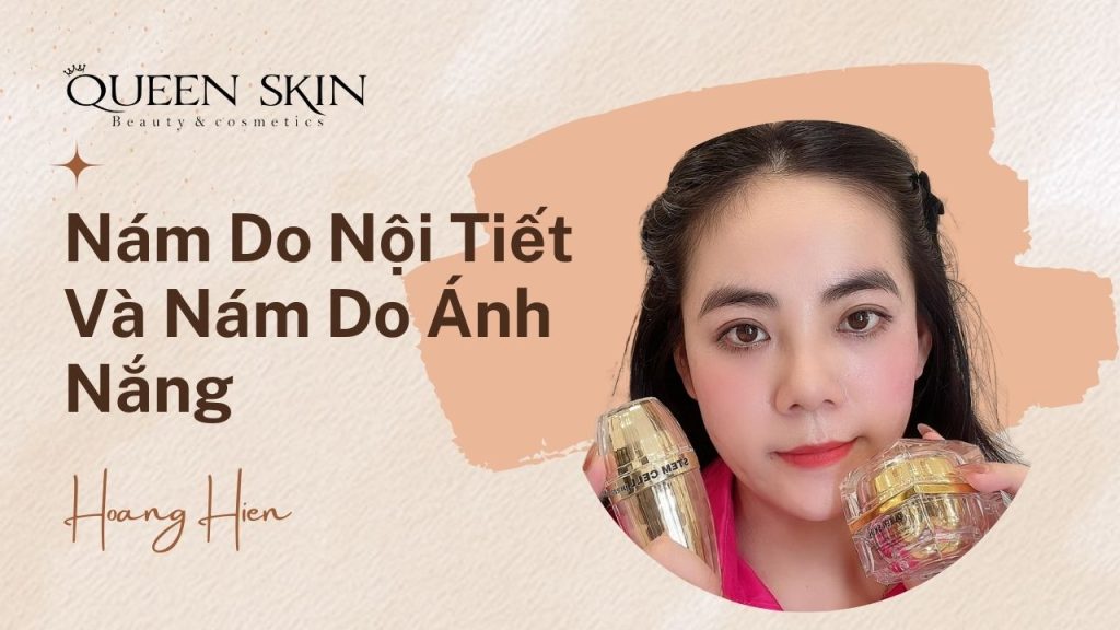 Nám nội tiết và nám do ánh nắng
